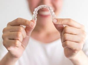 aparelho invisalign