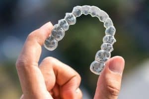 tecnologia invisalign