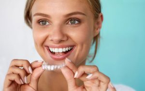 aparelho Invisalign